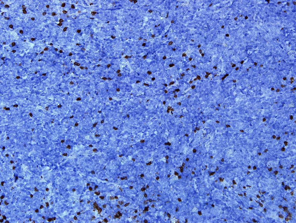 CD3